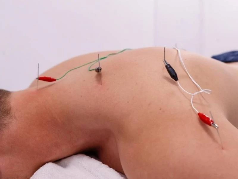 Fisioterapeutas en Pozuelo de Alarcón