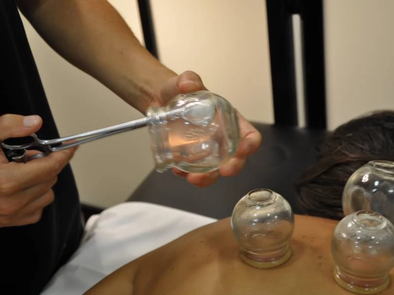 Lifting facial con agujas en Acupuntura Rosa G. Tardón