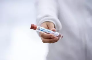 Datos actualizados del número de contagios por Covid19 en Boadilla del Monte