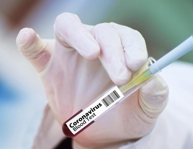 Continúa aumentando el número de casos de coronavirus en Boadilla