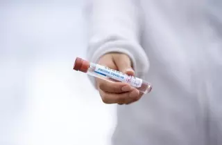 Baja la tasa de contagio por coronavirus en Boadilla del Monte
